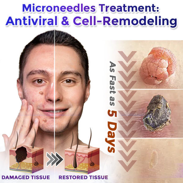 🌟Celsiora® Multi-Functional Microneedle Hydrocolloid Patch Roll | Targets Skin Tags, Warts & Stubborn Blemishes