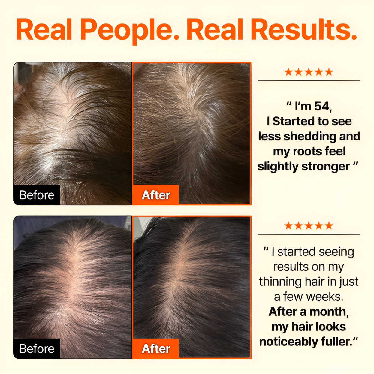 🕊Rootsfix™ GrowTurn Hair Brush Serum