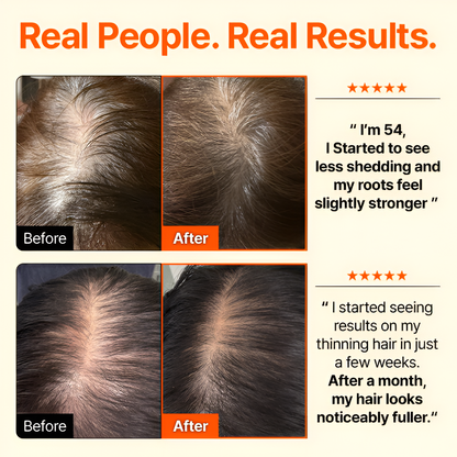🕊Rootsfix™ GrowTurn Hair Brush Serum